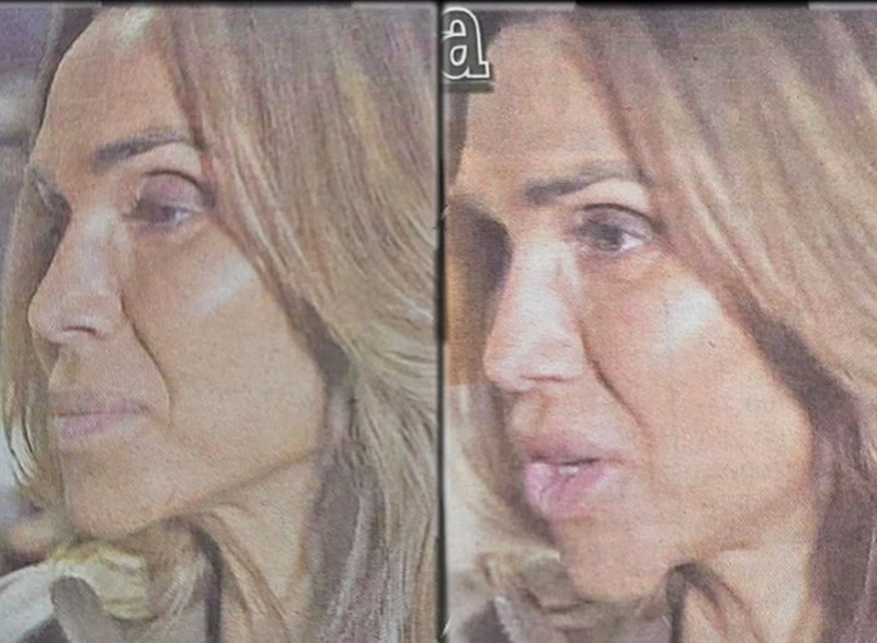 Ивайла Бакалова се обезобрази