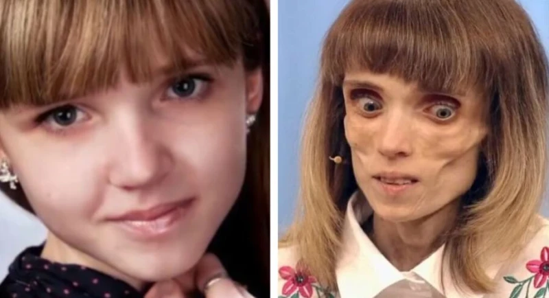 Тя тежи 17 кг, за да е съвършена