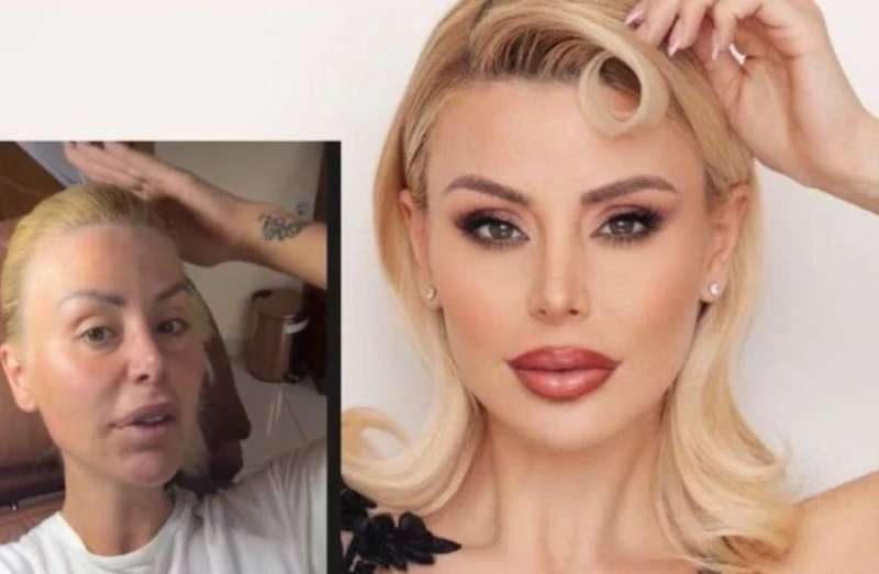 Светлана, бивша Гущерова, стана жертва на разкрасителна процедура