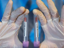Турция успокои България и региона: Няма опасност от хантавирус