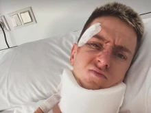 Тадей Погачар показа тежките последствия от катастрофата си на Вуелтата