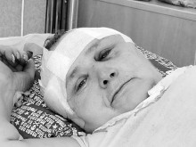 Асеновградчанка оцеля по чудо след два изстрела в слепоочията