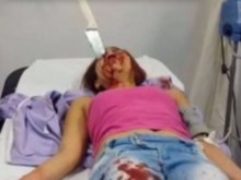 Шокиращо видео: Жена оцеля с нож в черепа