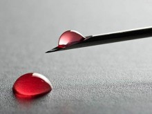 Над 100 000 у нас имат хепатит С, едва 3% знаят