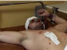 MMA боецът бил друсан с взривоопасна смес от анаболи и наркотици