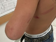 Читател: Цивилни полицаи пребиха момче в дискотека! Пращам и снимки!