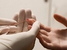 Здравната каса ще плаща най-съвременното лечение на хепатит С