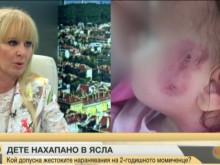 2-годишно дете зверски нахапано в ясла
