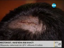Общински съветник от ДПС преби рибар