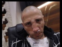 Задържаха сводниците и проститутките, нападнали варненския фотограф