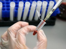 Британец може да е първият излекуван от ХИВ