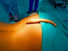 Отстраниха 18-сантиметрова опашка на младеж, местните го почитали като бог