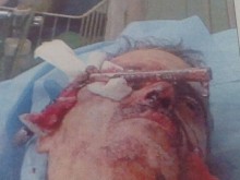 Мъжът с ножа в главата хванал любимата на калъп с брат си (18+)
