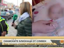 Няма лекар, който да раздели сиамските близнаци