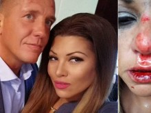 Пребита ли е Сани Алекса, или всичко е лъжа? Шведът с шокираща версия!