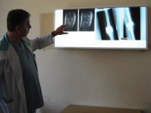 Пловдивски лекари разказаха как точно са спасили от ампутация крака на жена