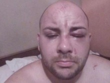 Зверско безчинство! Цигани пребиха жестоко две момчета!