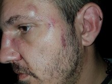 25 цигани начело с Кальо Тарзана пребиха рапъра Ицака МС заради забележка