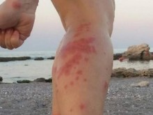 Бонус от БДЖ: Дървеници нахапаха зверски семейство във влак