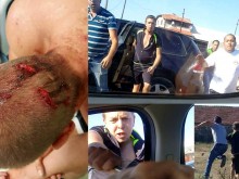 Това ли е лека телесна повреда? Вижте непоказвани кадри от жестокото клане в Айтос (+18)