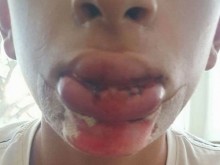 Цигани нападнаха и пребиха с нечувана жестокост дете в София (СНИМКА 18+)