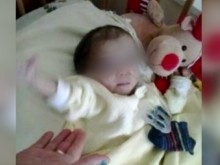 Състоянието на сиамските близнаци от Сливен се влошава