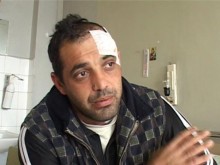 Мъж живее 4 години с куршум в главата след пиянска свада
