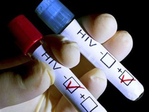 За пореден заразен за тази година с ХИВ съобщават от