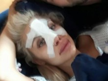 Джулиана Гани резна носа си в Германия: Искам да ми стане по-кукленски