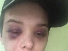 Албанец преби жестоко бременна сръбкиня, отказала да спи с него (18+)