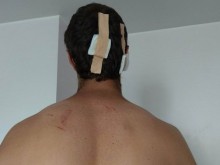 Вижте жестоките последствия от ромския побой над шофьор в София