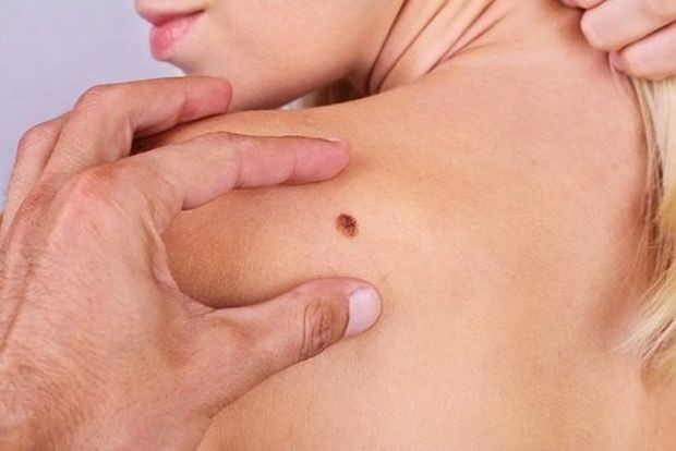 16% от случаите на рак на кожата могат да бъдат