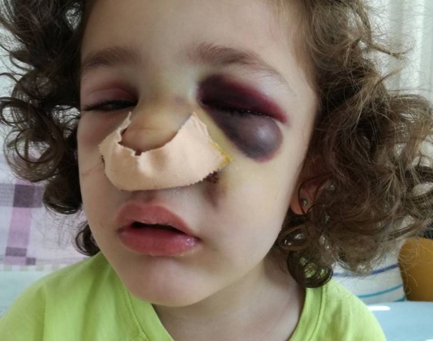 4-годишната Ламбина Ламбова, която пострада при инцидент в детска градина
