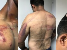 Ромите от екшъна с полицаите със скандални твърдения, говорят за страшни мазета и жесток побой