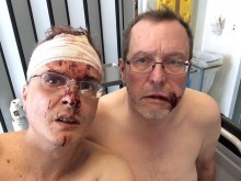 Българин и гаджето му пребиха жестоко италианска гей двойка (18+)