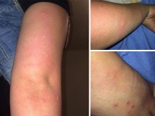 Бунт в общежитията на ТУ в Пловдив! Студентите пропищяха от дървеници