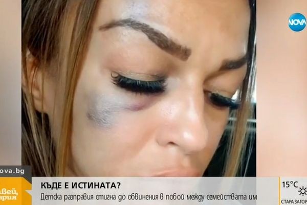 Жена от Сандански твърди, че е била брутално пребита на