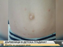 Родители сигнализираха, че децата им са нахапани от дървеници в градина