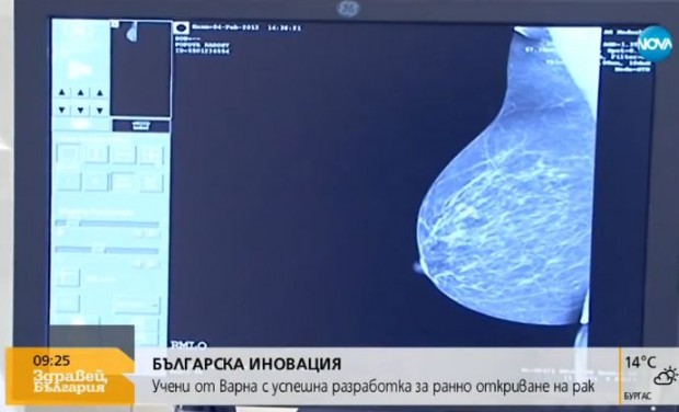 Български учени разработват нова технология за ранно откриване на рак.