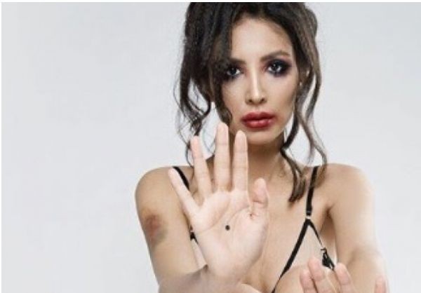 Депутатката и модел Динагюл Тасова публикува шокиращи снимки след свирепия
