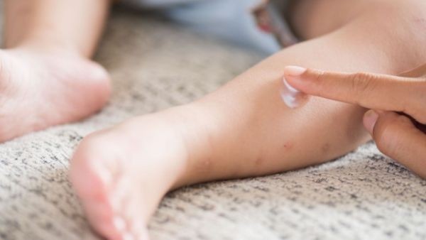 Има 3000 ваксини против морбили за децата до 18-годишна възраст