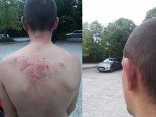 Баща твърди, че полицаи са пребили сина му
