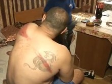 Ром със счупени ребра се оплака от полицейско насилие, полицаите с друга версия