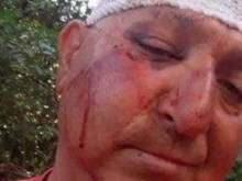 Баща и син пребиха зверски съседите си без причина