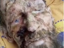Страховити кадри на мъж, оцелял цял месец в мечешка бърлога (18+)