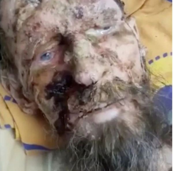 Намериха жив в бърлога на мечка мъж приличащ на мумия