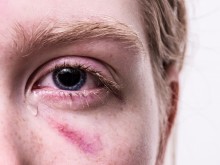 5 жени на ден търсят помощ от насилие, 28 са загубили живота си за една година