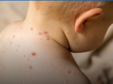 Важно за всички родители! Извънредна имунизационна кампания!