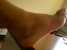 Бойко на шоуто в Пловдив с патерици