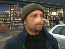Отхапаха носа на мъж след див скандал на пътя в "Люлин"